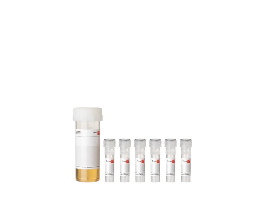Renal Epithelial Cell Growth Medium 2 | PromoCell