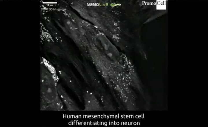 Cells in action: Differentiation of human mesenchymal stem cells into ...
