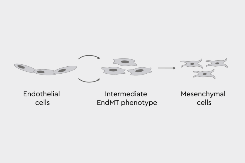Endothelial to mesenchymal transition