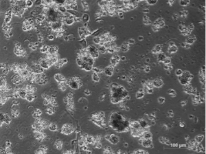 Cancer cells showing a tumorsphere-forming growth pattern on day 13 of culture