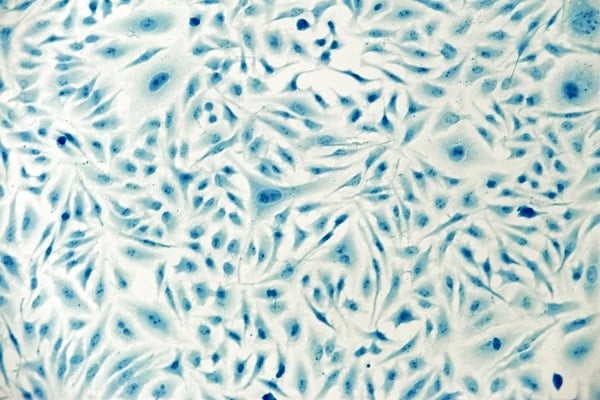 Microscopic images of HeLa cells