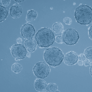 microscope-picture-tumorspheres