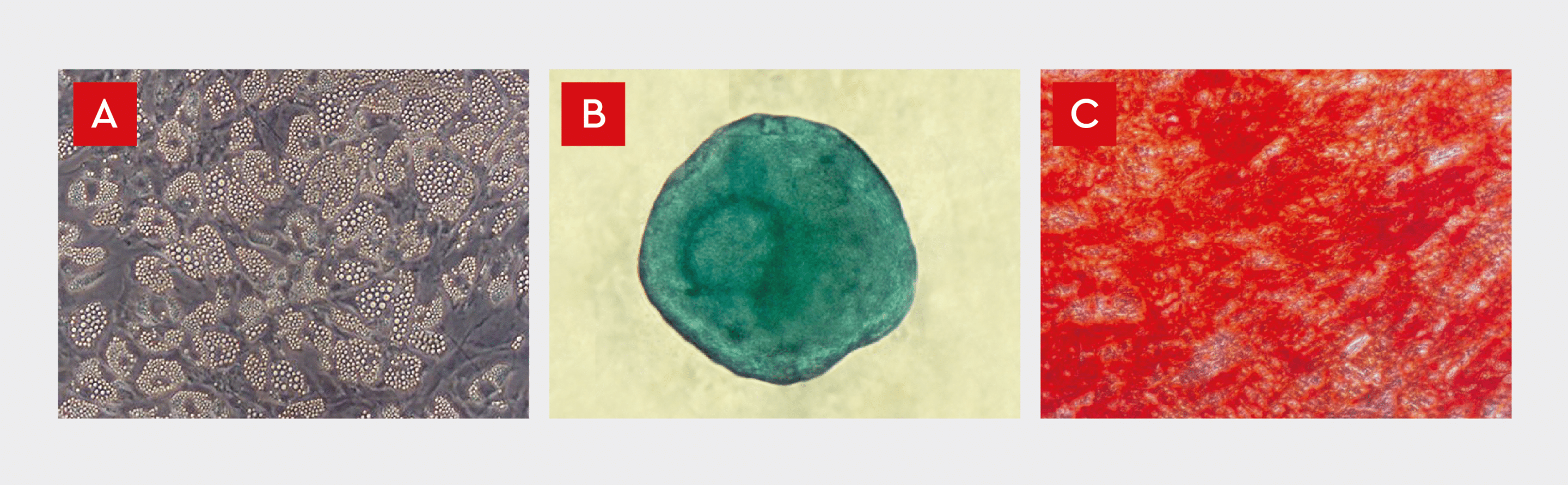 The differentiation of human MSCs into adipocytes, chondrocytes, and osteoblasts.