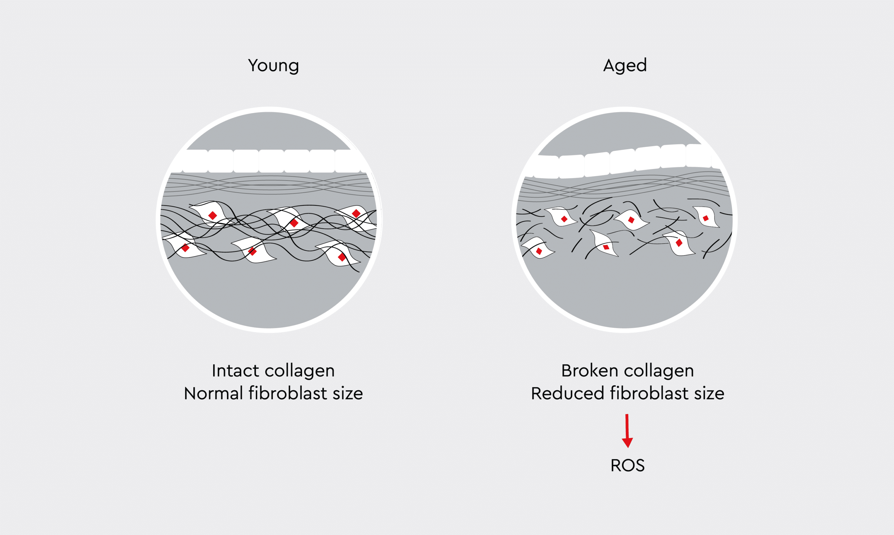 Collagen breakdown in aged skin and the impact of ROS.