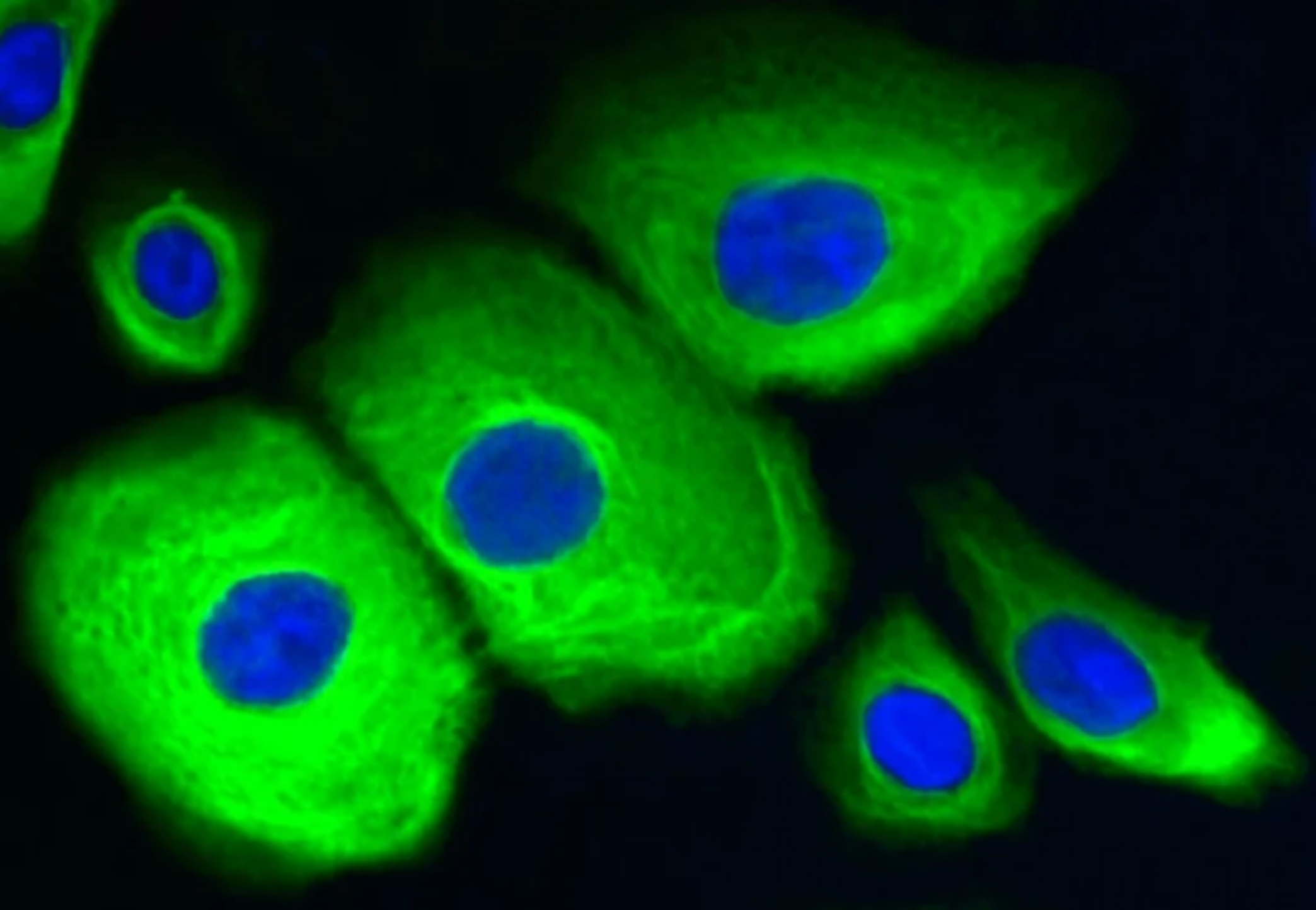 Fluorescence image of Normal Human Epidermal Keratinocytes stained for cytokeratin in green and nuclei counterstained with DAPI in blue.