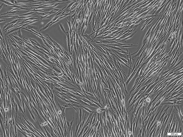 Primary cancer stem cell culture from GIST in PCCS.