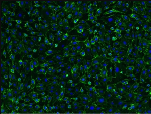 HUVECs stained with CD31.