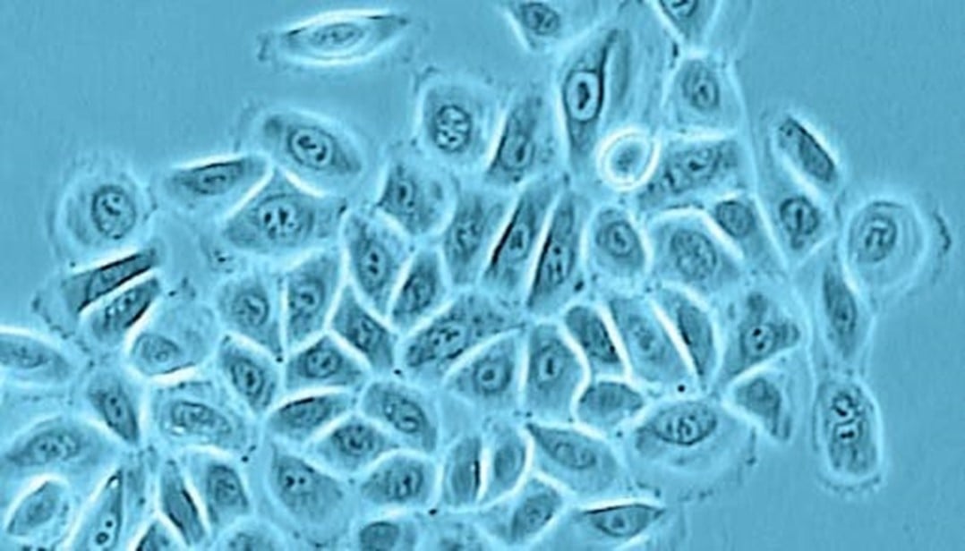 Phase-contrast image of Normal Human Epidermal Keratinocytes showing epithelial cell morphology in culture.