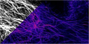 Confocal-vs-STED_Leica.
