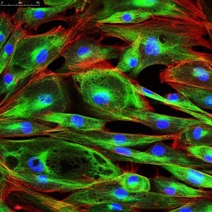 Fibroblasts