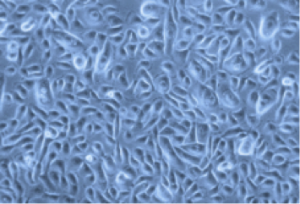 Human-small-airway-epithelial-cells