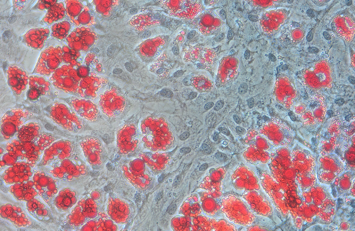Your preadipocyte model influences your results