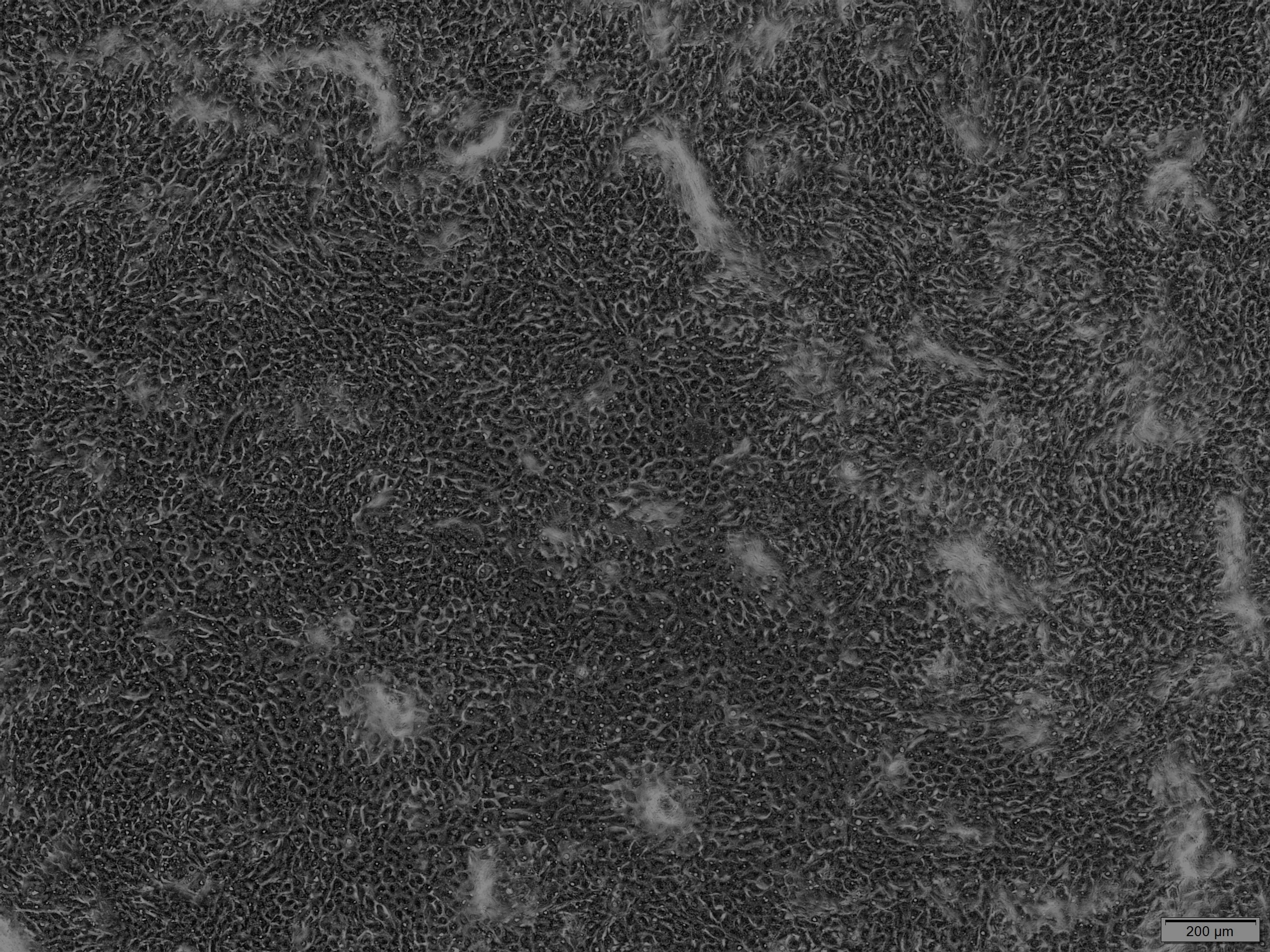 Air-liquid interface culture