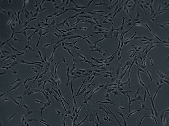 Are you using the right cell detachment method?