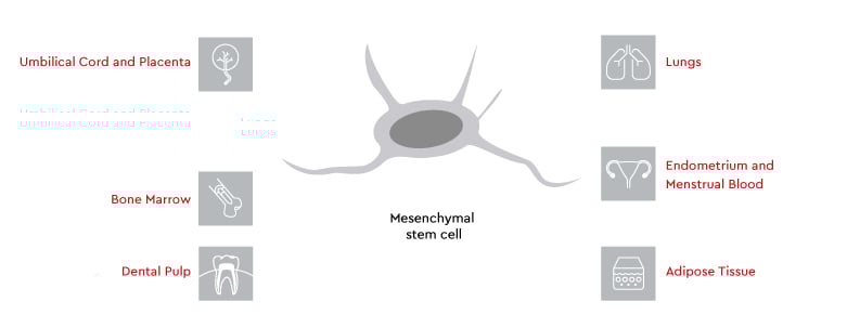 Illustration of a mesenchymal stem cell and the possible sources.