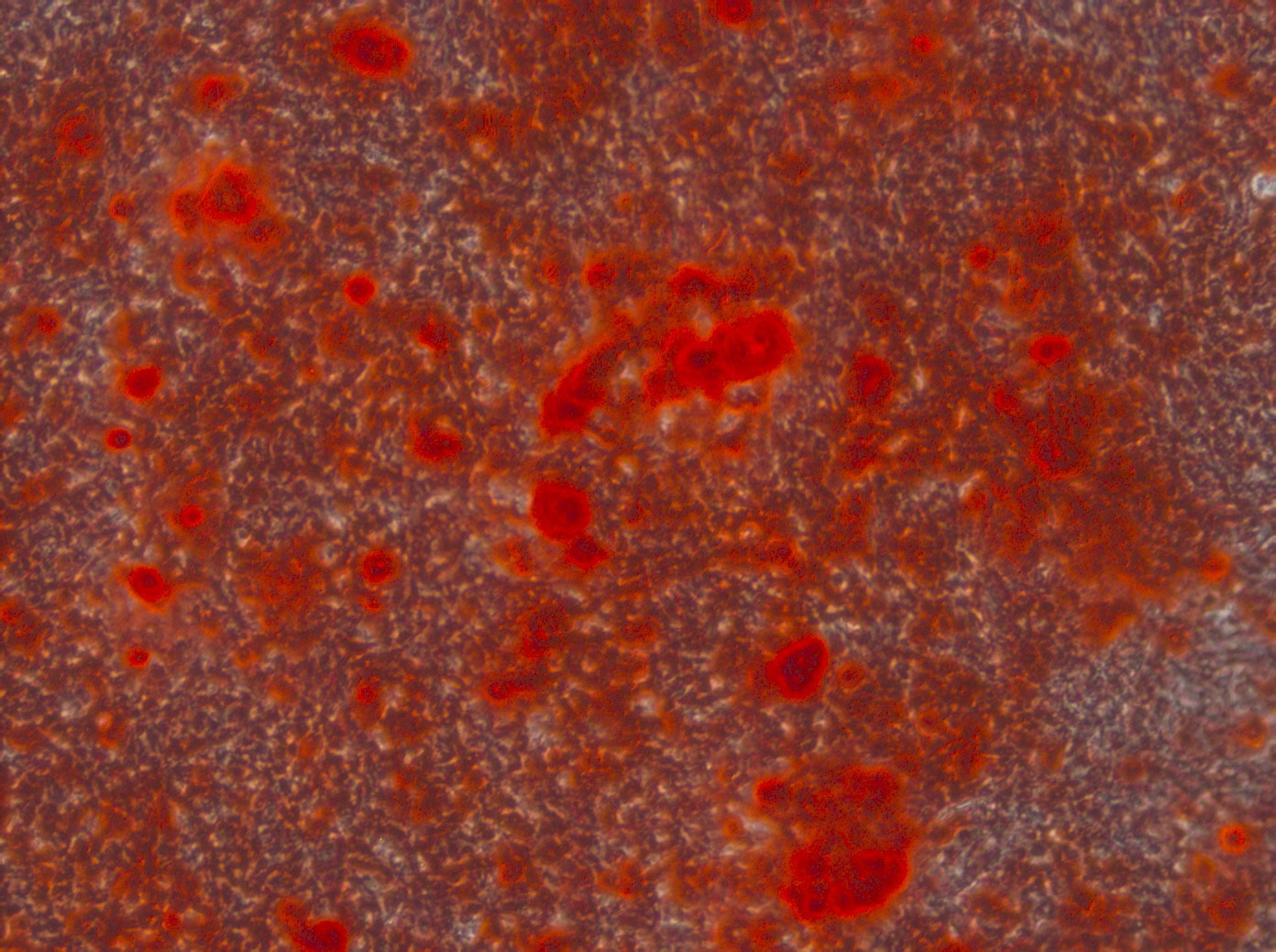 human osteoblast cell culture alizarin red s