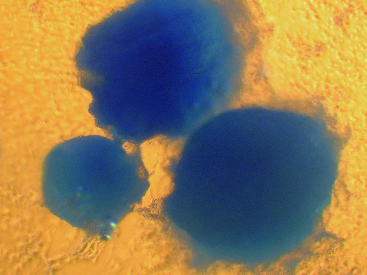 Human Chondrocyte Cell Culture Differentiated Alcian Blue