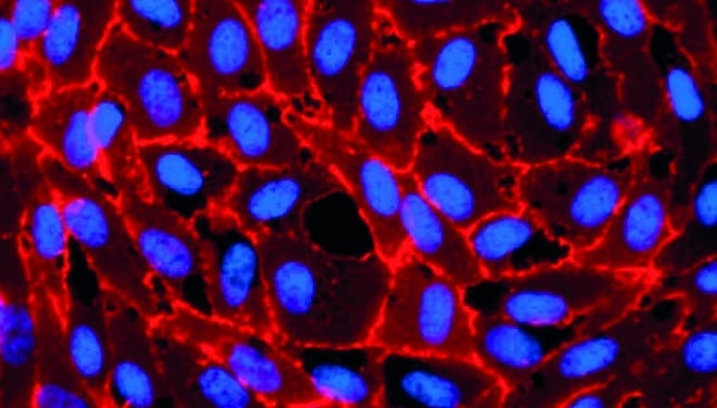 Кровеносная ткань. Endothelial Cell. Реснитчатые клетки эндотелия сосуда. Эндотелий под микроскопом. Антитела к клеткам сосудистого эндотелия.