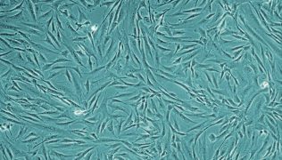 Human Follicle Dermal Papilla Cellculture