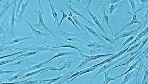 Human Follicle Dermal Papilla Cell Culture