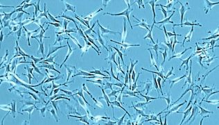 human-melanocyte-cell-culture