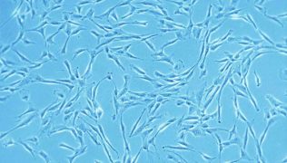 Mesenchymal Stem Cell Culture