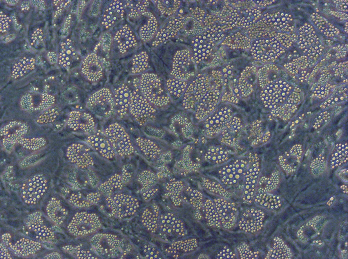 Human Mesenchymal Stem Cell Culture From Bone Marrow Differentiated into adipocytes