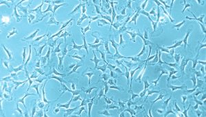 Human Mesenchymal Stem Cell Culture from Bone Marrow undifferentiated in growth medium