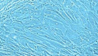 Myocyte Cell Culture