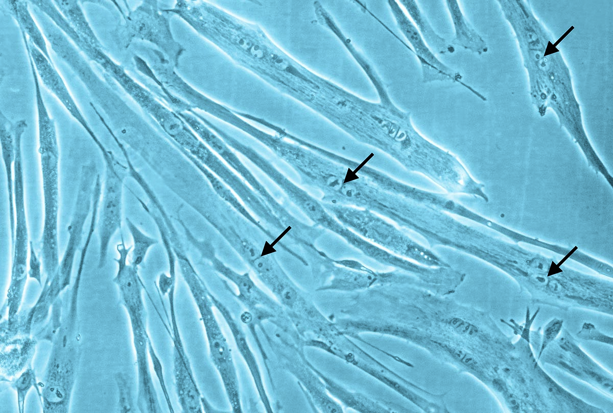 Human Skeletal Muscle Cell Culture Differentiated