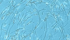 Human Skeletal Muscle Cell Culture Undifferentiated