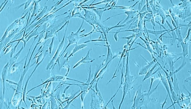 Human Skeletal Muscle Cells (SkMC) | PromoCell
