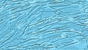 Human tracheal smooth muscle cell culture
