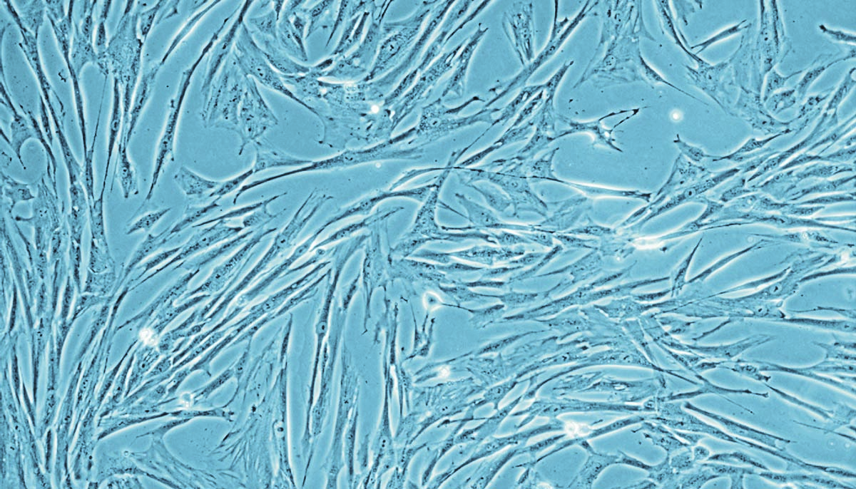 Human umibilical Artery smooth muscle cell culture