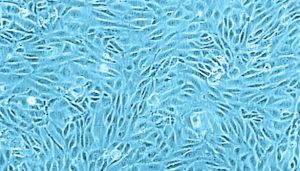 Human Umbilical Vein Endothelial Cell Culture Huvec