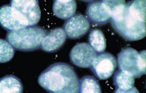 Mycoplasma Contaminated Cells