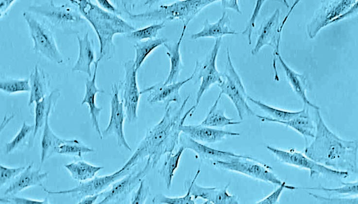 Normal Human Dermal Fibroblast Cell Culture