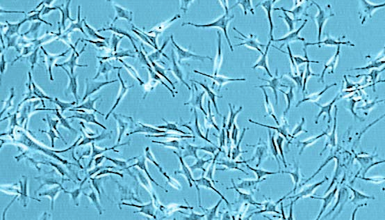 normal-human-epidermal-melanocyte-cell-culture-in-growth-medium-2