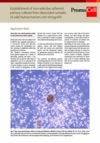 AppNote_Non-selective tumor cell culture_Thumbnail