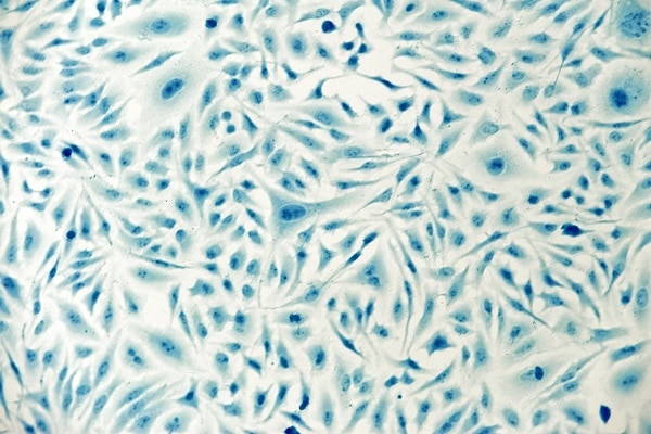 PromoCell - Cell Culture - HeLa cells
