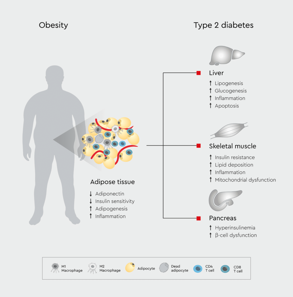 The interconnected relationship between obesity and type 2 diabetes, highlighting the impact on key tissues: adipose tissue, liver, skeletal muscle, and pancreas.